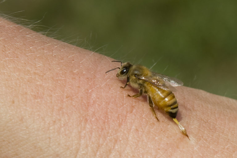 effects-of-a-wasp-sting-wasp-removal-toronto